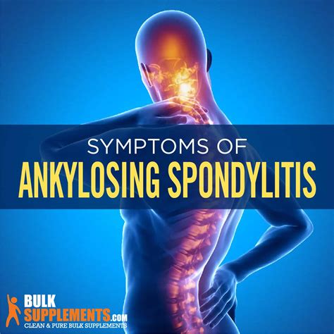 ankylosing spondylitis 뜻